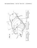 PHSYSIOLOGICAL SIMULATOR FOR USE AS A BRACHIAL PLEXUS NERVE BLOCK TRAINER diagram and image