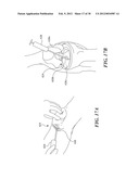 PHSYSIOLOGICAL SIMULATOR FOR USE AS A BRACHIAL PLEXUS NERVE BLOCK TRAINER diagram and image