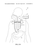 PHSYSIOLOGICAL SIMULATOR FOR USE AS A BRACHIAL PLEXUS NERVE BLOCK TRAINER diagram and image