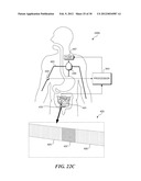 PHSYSIOLOGICAL SIMULATOR FOR USE AS A BRACHIAL PLEXUS NERVE BLOCK TRAINER diagram and image