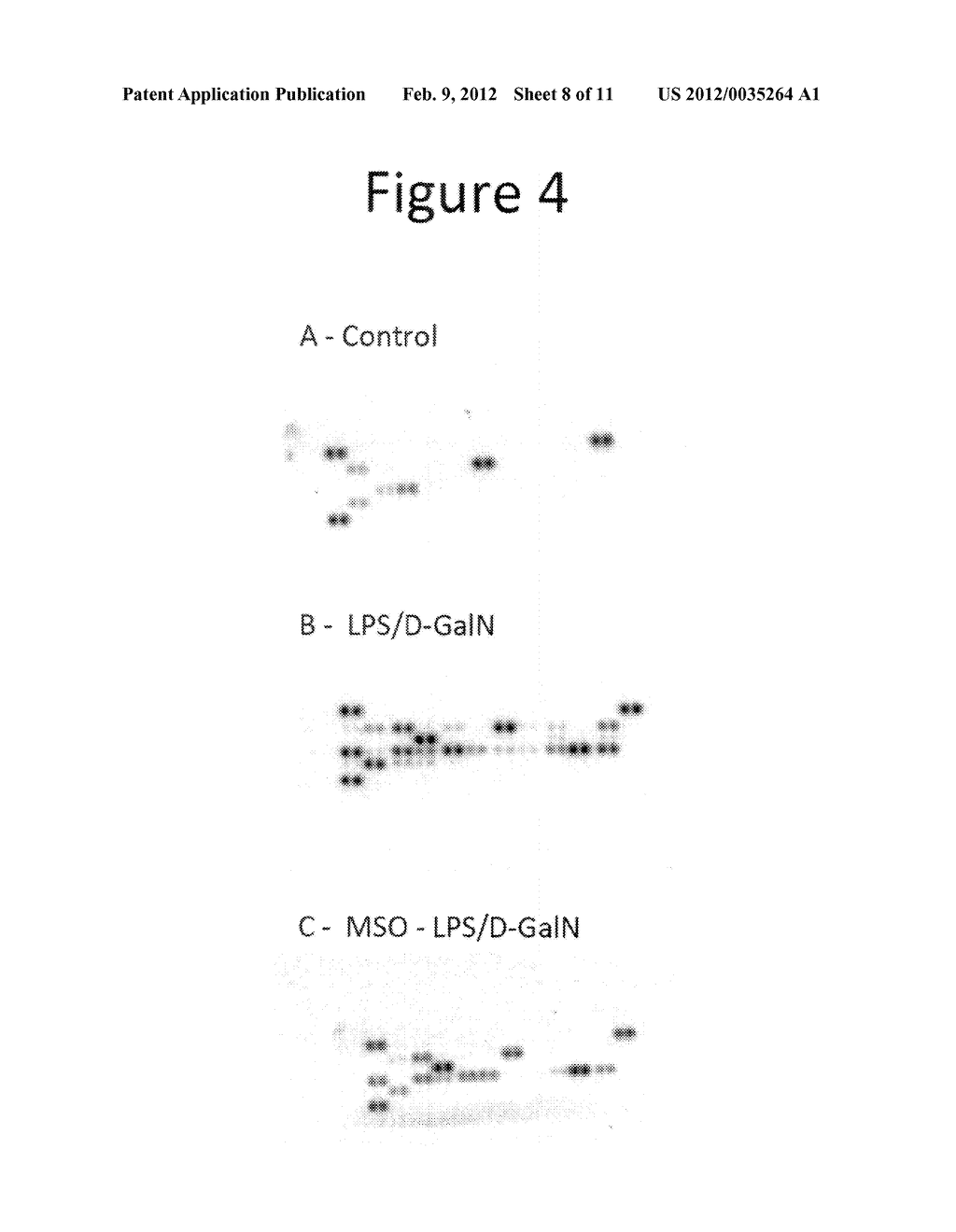 Use of methionine sulfoximine to treat acute liver failure and other     diseases caused by an inflammatory cytokine response - diagram, schematic, and image 09