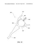 IMAGING SENSOR WITH THERMAL PAD FOR USE IN A SURGICAL APPLICATION diagram and image