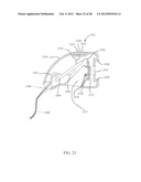 IMAGING SENSOR WITH THERMAL PAD FOR USE IN A SURGICAL APPLICATION diagram and image