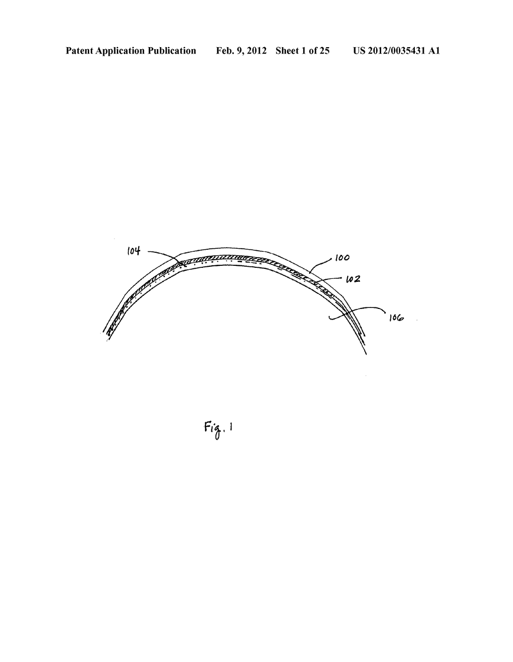 Devices and methods for monitoring physiological information relating to     sleep with an implantable device - diagram, schematic, and image 02