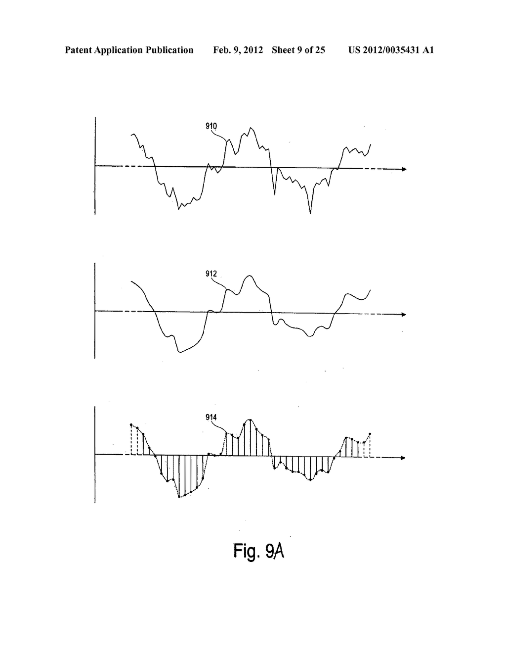 Devices and methods for monitoring physiological information relating to     sleep with an implantable device - diagram, schematic, and image 10