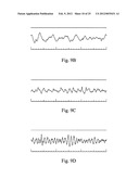 Devices and methods for monitoring physiological information relating to     sleep with an implantable device diagram and image