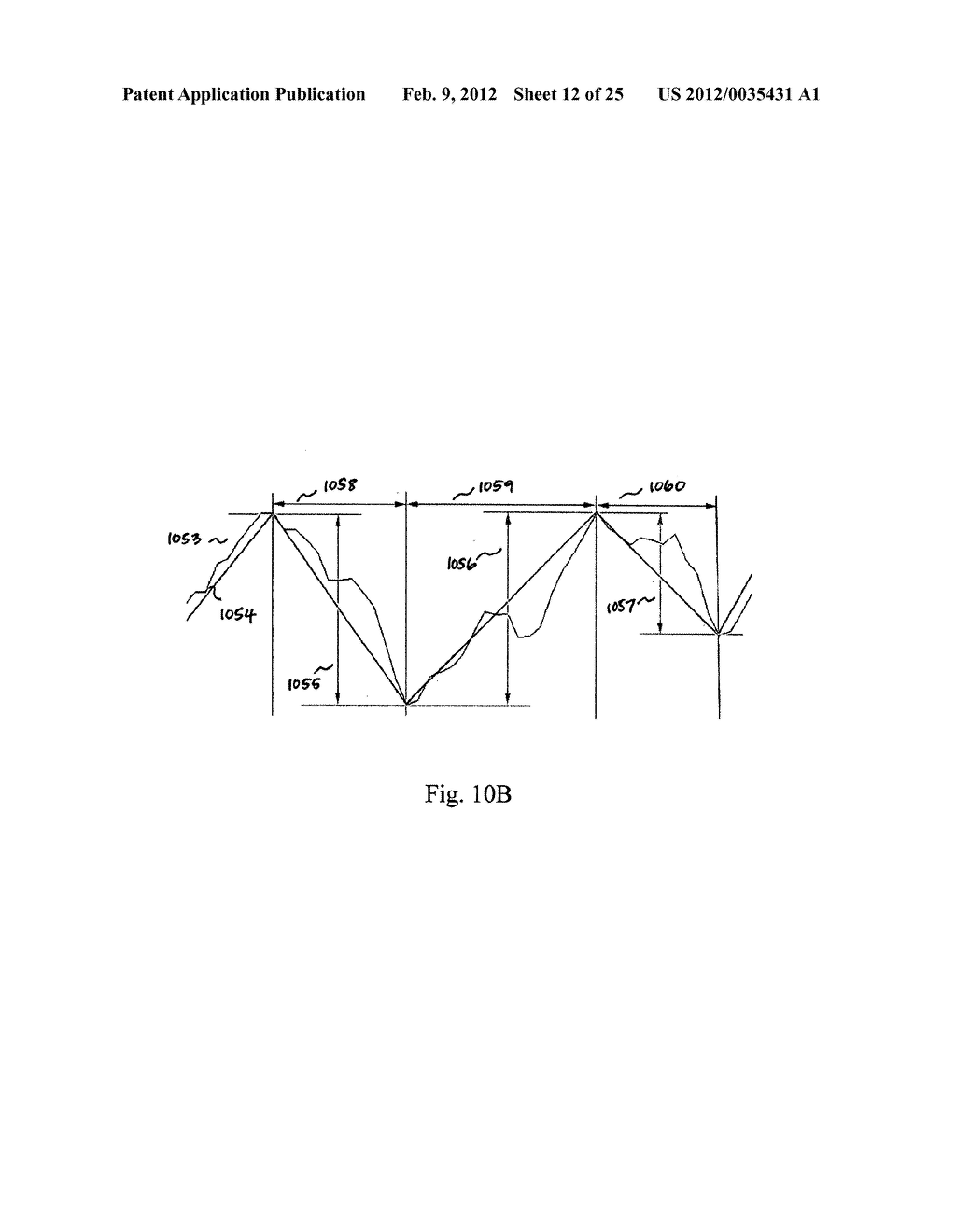 Devices and methods for monitoring physiological information relating to     sleep with an implantable device - diagram, schematic, and image 13