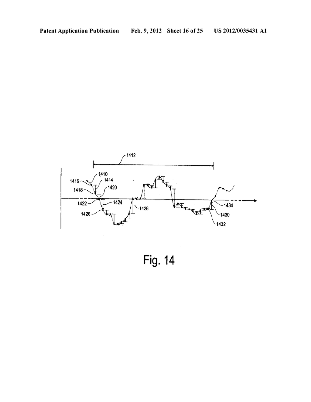 Devices and methods for monitoring physiological information relating to     sleep with an implantable device - diagram, schematic, and image 17