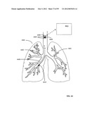 Control of a lumen traveling device in a body tube tree diagram and image