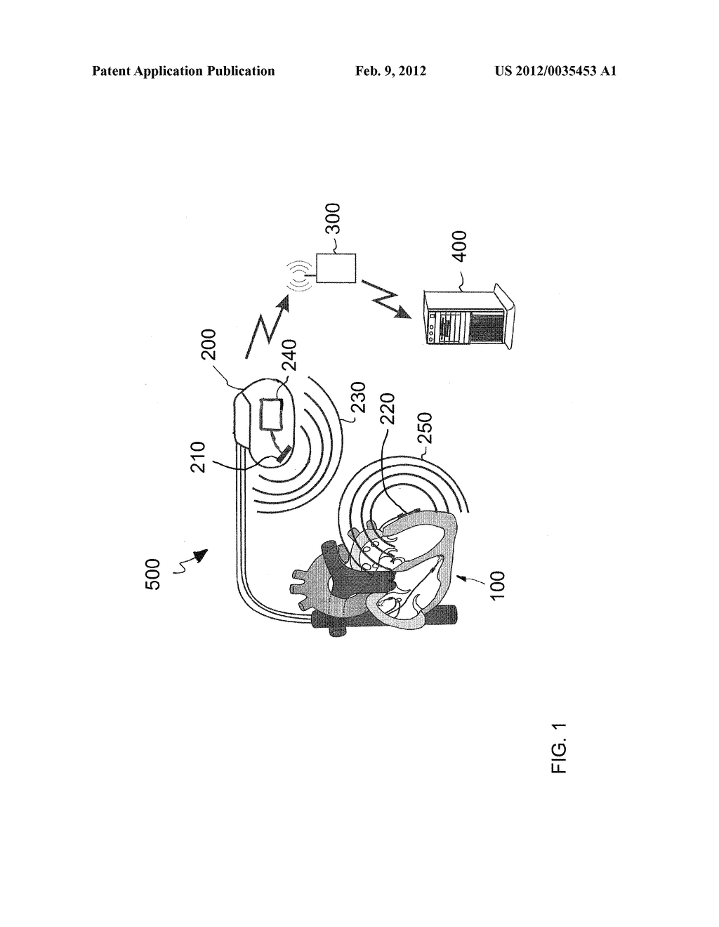 IMPLANT AND SYSTEM FOR PREDICTING DECOMPENSATION - diagram, schematic, and image 02