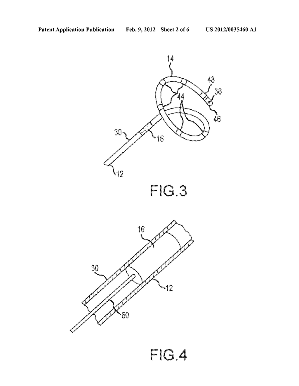 MOVABLE MAGNET FOR MAGNETICALLY GUIDED CATHETER - diagram, schematic, and image 03