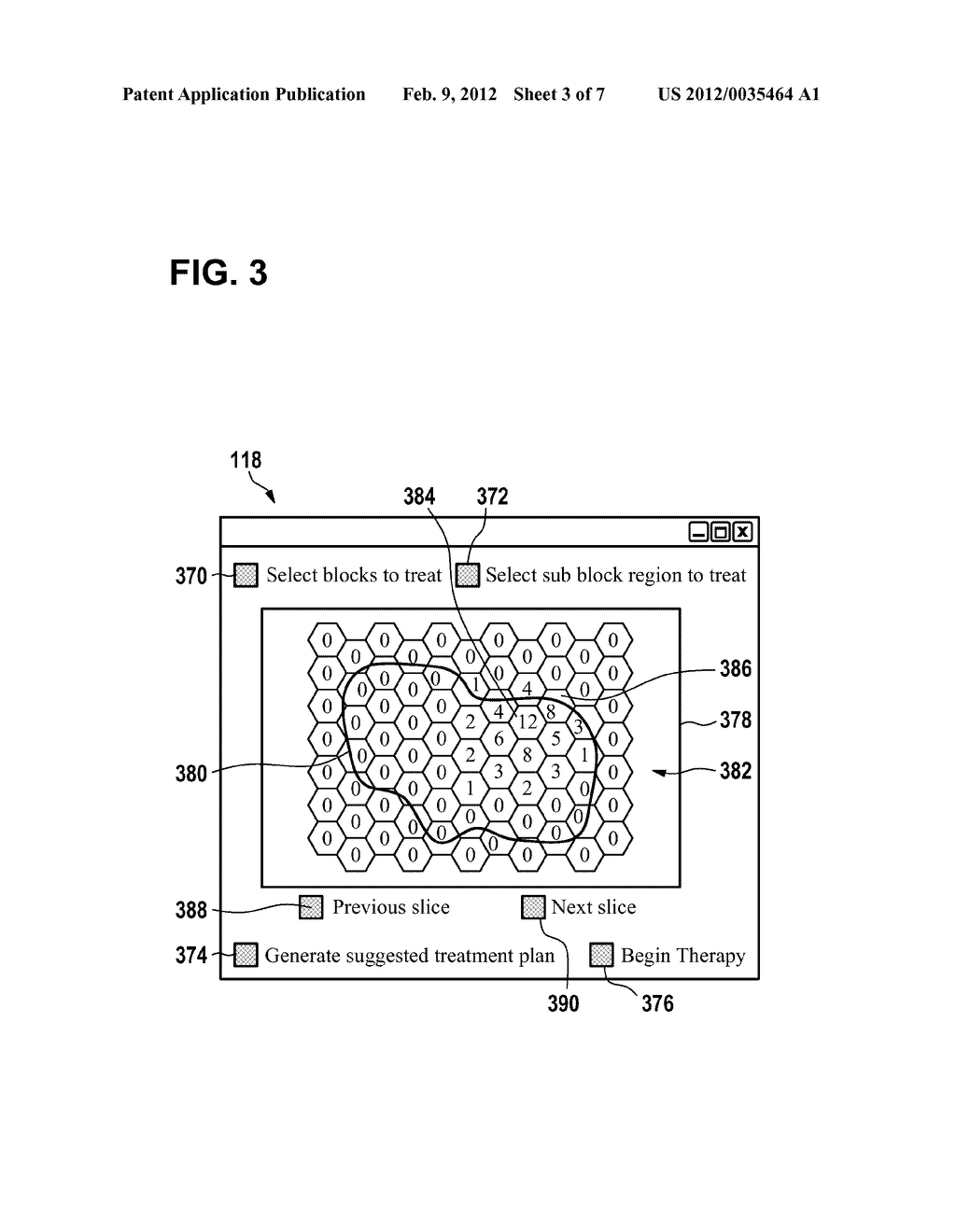 CONTROL APPARATUS FOR CONTROLLING A THERAPEUTIC APPARATUS - diagram, schematic, and image 04