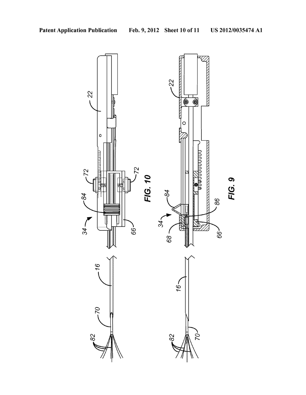 ABLATION DEVICE WITH ARTICULATED IMAGING TRANSDUCER - diagram, schematic, and image 11