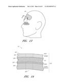 METHODS FOR NON-INVASIVE COSMETIC TREATMENT OF THE EYE REGION diagram and image