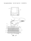 METHODS FOR NON-INVASIVE COSMETIC TREATMENT OF THE EYE REGION diagram and image