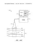 METHODS FOR NON-INVASIVE COSMETIC TREATMENT OF THE EYE REGION diagram and image