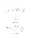 METHODS FOR NON-INVASIVE COSMETIC TREATMENT OF THE EYE REGION diagram and image