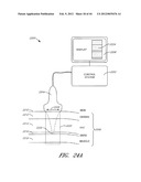 Tissue Imaging And Treatment Method diagram and image