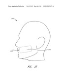 Tissue Imaging And Treatment Method diagram and image