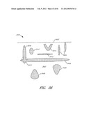 Tissue Imaging And Treatment Method diagram and image