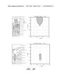 Tissue Imaging And Treatment Method diagram and image