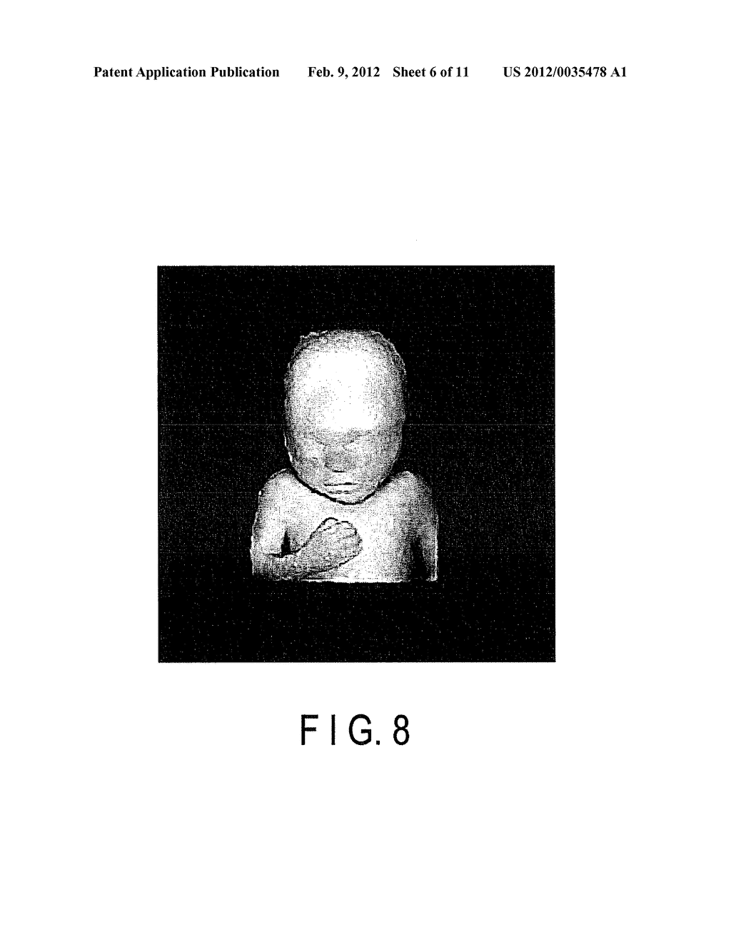 ULTRASONIC DIAGNOSTIC APPARATUS AND AN ULTRASONIC IMAGE PROCESSING     APPARATUS - diagram, schematic, and image 07