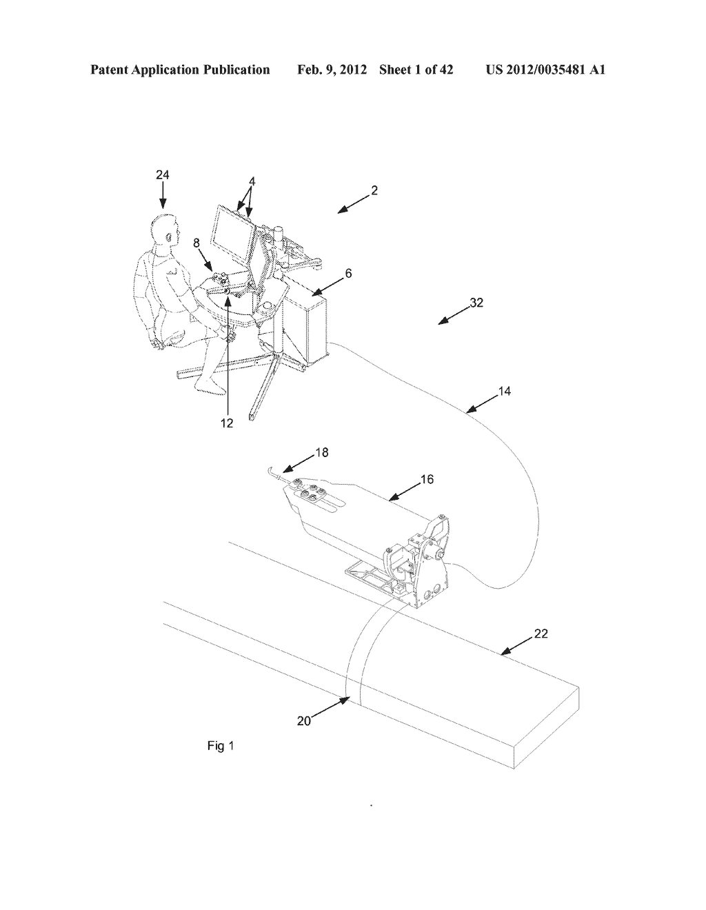 SYSTEMS AND METHODS FOR THREE-DIMENSIONAL ULTRASOUND MAPPING - diagram, schematic, and image 02