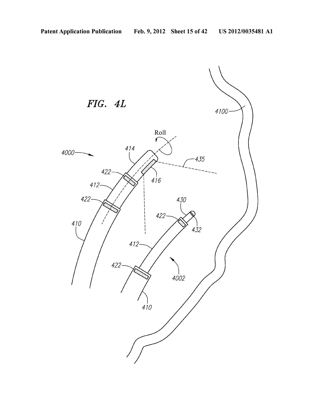 SYSTEMS AND METHODS FOR THREE-DIMENSIONAL ULTRASOUND MAPPING - diagram, schematic, and image 16