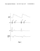 PULSE DETECTION USING PATIENT PHYSIOLOGICAL SIGNALS diagram and image