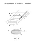 METHODS AND DEVICES FOR CUTTING AND COLLECTING SOFT TISSUE diagram and image