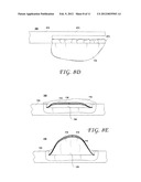 METHODS AND DEVICES FOR CUTTING AND COLLECTING SOFT TISSUE diagram and image