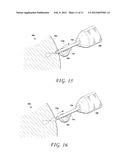 METHODS AND DEVICES FOR CUTTING AND COLLECTING SOFT TISSUE diagram and image