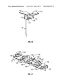 SAFETY NEEDLE WITH POSITIVE FLUSH diagram and image