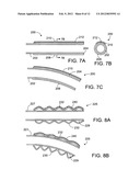 MEDICAL DEVICES INCLUDING SHAPE MEMORY MATERIALS diagram and image