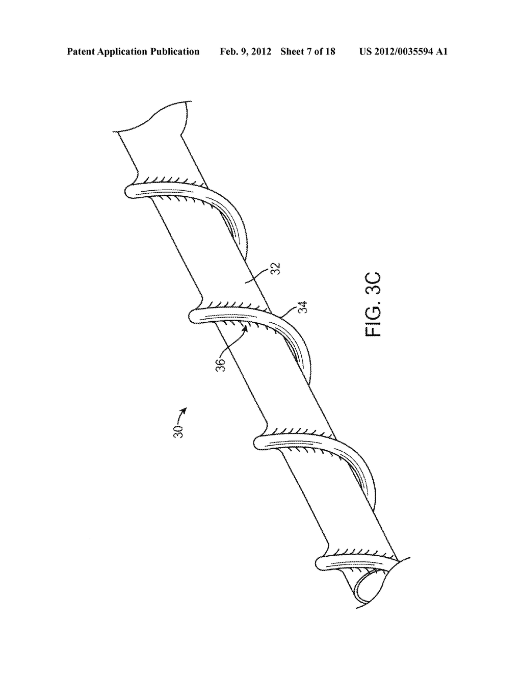 MECHANICAL PUMP FOR REMOVAL OF FRAGMENTED MATTER AND METHODS OF     MANUFACTURE AND USE - diagram, schematic, and image 08