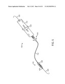 MECHANICAL PUMP FOR REMOVAL OF FRAGMENTED MATTER AND METHODS OF     MANUFACTURE AND USE diagram and image