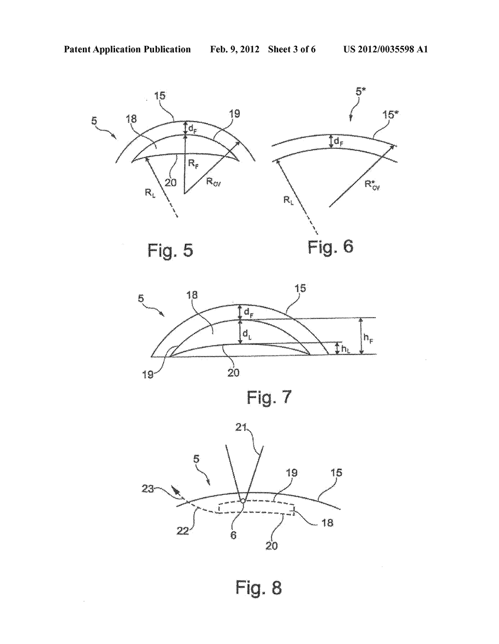 DEVICE AND METHOD FOR PRODUCING CONTROL DATA FOR THE SURGICAL CORRECTION     OF DEFECTIVE EYE VISION - diagram, schematic, and image 04