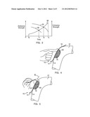 METHOD AND DEVICE FOR HANDLING BONE ADHESIVES diagram and image