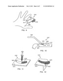 METHOD AND DEVICE FOR HANDLING BONE ADHESIVES diagram and image