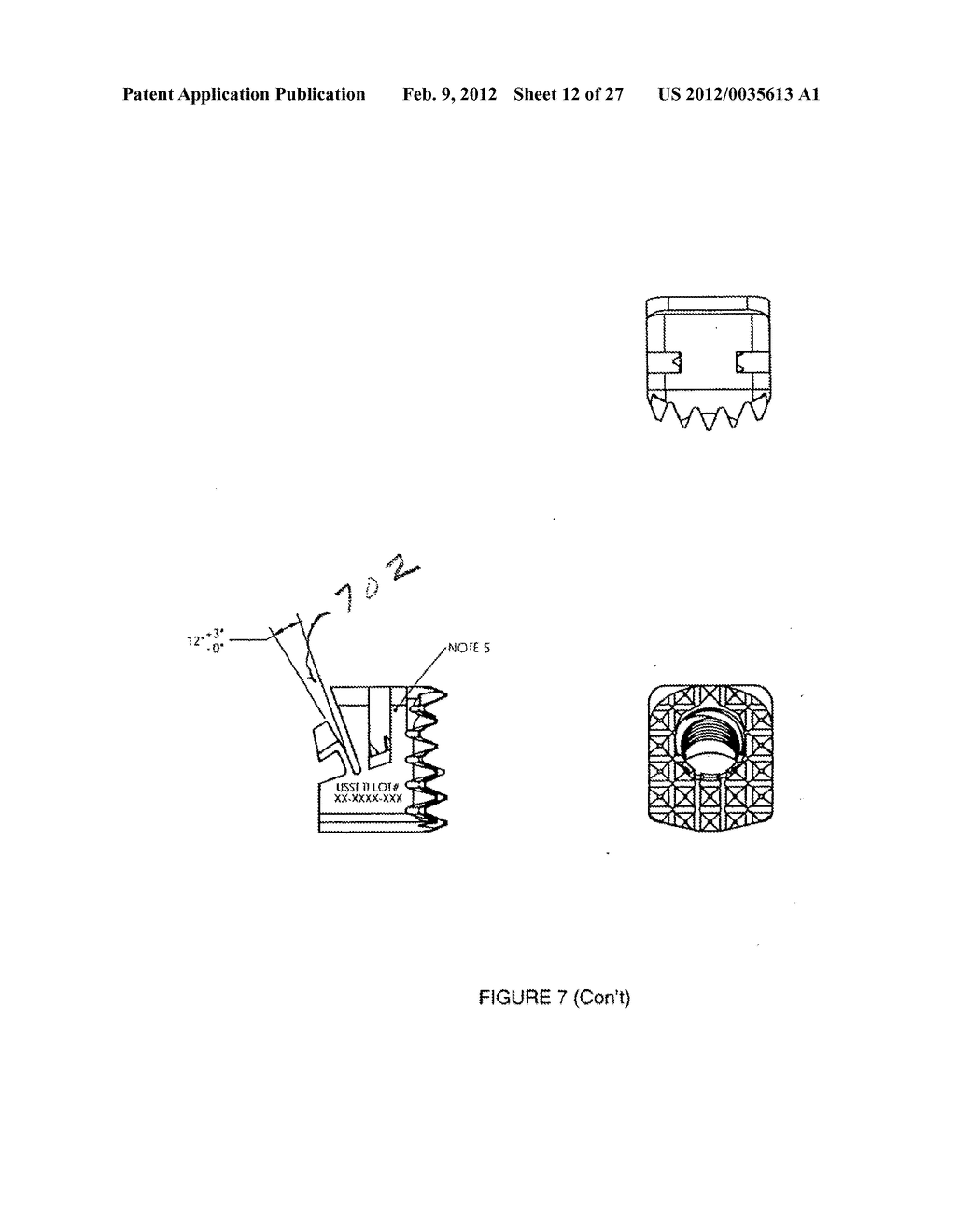 BONE FIXATION IMPLANT SYSTEM AND METHOD - diagram, schematic, and image 13