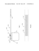 STEERING AN IMPLANTABLE MEDICAL LEAD VIA A ROTATIONAL COUPLING TO A STYLET diagram and image