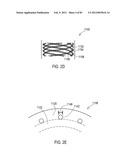 STEERING AN IMPLANTABLE MEDICAL LEAD VIA A ROTATIONAL COUPLING TO A STYLET diagram and image