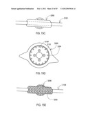 STEERING AN IMPLANTABLE MEDICAL LEAD VIA A ROTATIONAL COUPLING TO A STYLET diagram and image