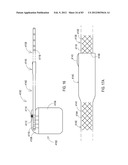 STEERING AN IMPLANTABLE MEDICAL LEAD VIA A ROTATIONAL COUPLING TO A STYLET diagram and image