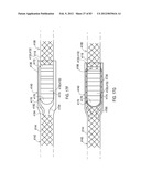 STEERING AN IMPLANTABLE MEDICAL LEAD VIA A ROTATIONAL COUPLING TO A STYLET diagram and image