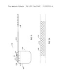 STEERING AN IMPLANTABLE MEDICAL LEAD VIA A ROTATIONAL COUPLING TO A STYLET diagram and image