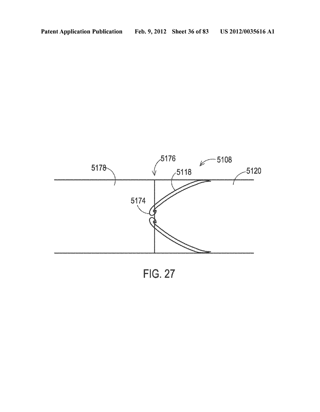 STEERING AN IMPLANTABLE MEDICAL LEAD VIA A ROTATIONAL COUPLING TO A STYLET - diagram, schematic, and image 37