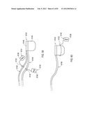 STEERING AN IMPLANTABLE MEDICAL LEAD VIA A ROTATIONAL COUPLING TO A STYLET diagram and image