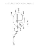 STEERING AN IMPLANTABLE MEDICAL LEAD VIA A ROTATIONAL COUPLING TO A STYLET diagram and image