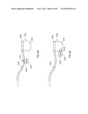 STEERING AN IMPLANTABLE MEDICAL LEAD VIA A ROTATIONAL COUPLING TO A STYLET diagram and image